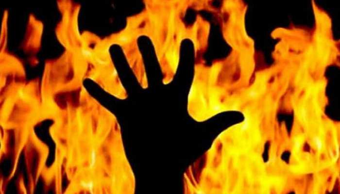 मध्य प्रदेशः दमोह में बेखौफ बदमाश ने आदिवासी बच्चे को लगाई आग मध्य प्रदेशः दमोह में बेखौफ बदमाश ने आदिवासी बच्चे को लगाई आग