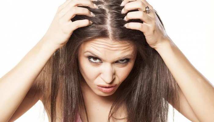 Home Remedies: सर्दियों में रूखे और बेजान बालों से हो गए हैं परेशान, तो ऐसे रखें ख्याल... Home Remedies: सर्दियों में रूखे और बेजान बालों से हो गए हैं परेशान, तो ऐसे रखें ख्याल...