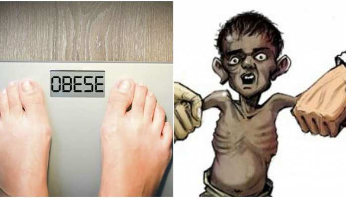 कुपोषण पर तेजी से हो रहा नियंत्रण, लेकिन अभी भी देश में 4.66 करोड़ कुपोषित बच्चे कुपोषण पर तेजी से हो रहा नियंत्रण, लेकिन अभी भी देश में 4.66 करोड़ कुपोषित बच्चे