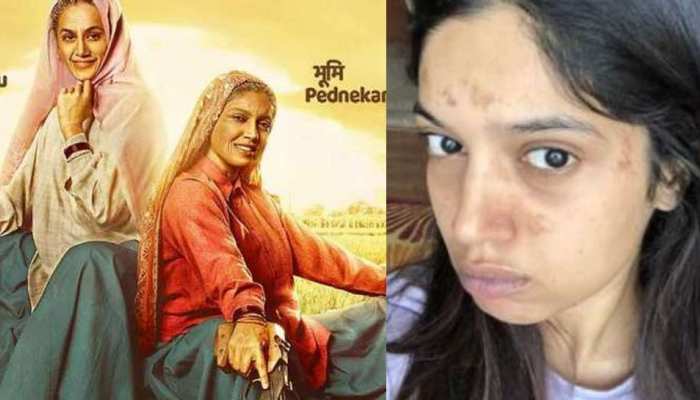 'सांड की आंख' की शूटिंग के दौरान झुलस गया भूमि पेडनेकर का चेहरा, PHOTO हुई VIRAL 'सांड की आंख' की शूटिंग के दौरान झुलस गया भूमि पेडनेकर का चेहरा, PHOTO हुई VIRAL