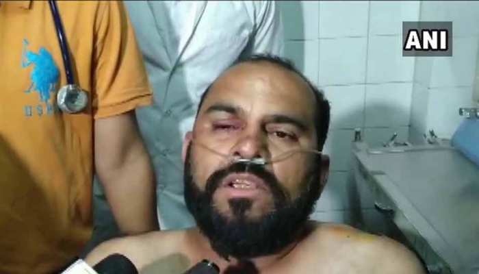 हार्दिक को थप्पड़ मारने वाले ने कहा- पाटीदार आंदोलन के समय पत्नी प्रेगनेंट थी, हुई थी परेशानी हार्दिक को थप्पड़ मारने वाले ने कहा- पाटीदार आंदोलन के समय पत्नी प्रेगनेंट थी, हुई थी परेशानी