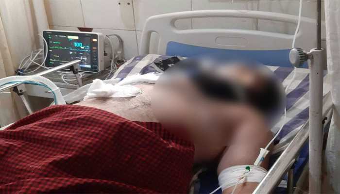 कर्जदार नहीं लौटा पाया पैसा, साहूकार ने पेट्रोल छिड़ककर पूरे परिवार को जिंदा जलाने की कोशिश की कर्जदार नहीं लौटा पाया पैसा, साहूकार ने पेट्रोल छिड़ककर पूरे परिवार को जिंदा जलाने की कोशिश की