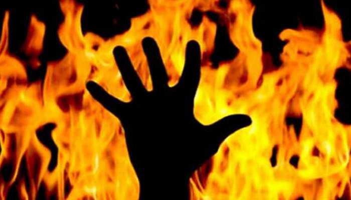 दर्दनाक... झोपड़ी में लगी आग, जिंदा जली डेढ़ साल की मासूम, दो ग्रामीण झुलसे दर्दनाक... झोपड़ी में लगी आग, जिंदा जली डेढ़ साल की मासूम, दो ग्रामीण झुलसे