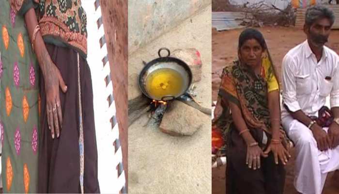 जमीन विवाद का अंधविश्वास से करना चाहते थे निबटारा, खौलते तेल में डाल दिया हाथ जमीन विवाद का अंधविश्वास से करना चाहते थे निबटारा, खौलते तेल में डाल दिया हाथ