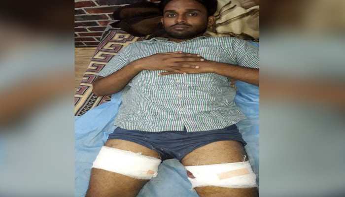 दिल्ली पुलिस ने लूट की वारदात को किया नाकाम, बदमाश के पैर में गोली मारकर पकड़ा दिल्ली पुलिस ने लूट की वारदात को किया नाकाम, बदमाश के पैर में गोली मारकर पकड़ा