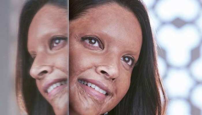 Ã Â¤Â¦Ã Â¥ÂÃ Â¤ÂªÃ Â¤Â¿Ã Â¤ÂÃ Â¤Â¾ Ã Â¤ÂªÃ Â¤Â¾Ã Â¤Â¦Ã Â¥ÂÃ Â¤ÂÃ Â¥ÂÃ Â¤Â£ Ã Â¤Â¨Ã Â¥Â Ã Â¤ÂÃ Â¤Â¸Ã Â¤Â²Ã Â¤Â¿Ã Â¤Â Ã Â¤ÂÃ Â¥ÂÃ Â¤Â¨Ã Â¤Â¾ &#039;Ã Â¤ÂÃ Â¤ÂªÃ Â¤Â¾Ã Â¤Â&#039; Ã Â¤ÂÃ Â¤Â¾ Ã Â¤ÂÃ Â¤Â¿Ã Â¤Â°Ã Â¤Â¦Ã Â¤Â¾Ã Â¤Â°! Ã Â¤Â¤Ã Â¥ÂÃ Â¤Â¯Ã Â¤Â¾Ã Â¤Â°Ã Â¥Â Ã Â¤ÂÃ Â¥Â Ã Â¤Â²Ã Â¥ÂÃ Â¤ÂÃ Â¤Â° Ã Â¤Â­Ã Â¥Â Ã Â¤ÂÃ Â¤Â¿Ã Â¤Â¯Ã Â¤Â¾ Ã Â¤ÂÃ Â¥ÂÃ Â¤Â²Ã Â¤Â¾Ã Â¤Â¸Ã Â¤Â¾