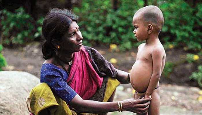 सीकर: नीमकाथाना में पोषण माह में स्वयं सहायक समूह की बैठक, कुपोषण पर हुई चर्चा सीकर: नीमकाथाना में पोषण माह में स्वयं सहायक समूह की बैठक, कुपोषण पर हुई चर्चा
