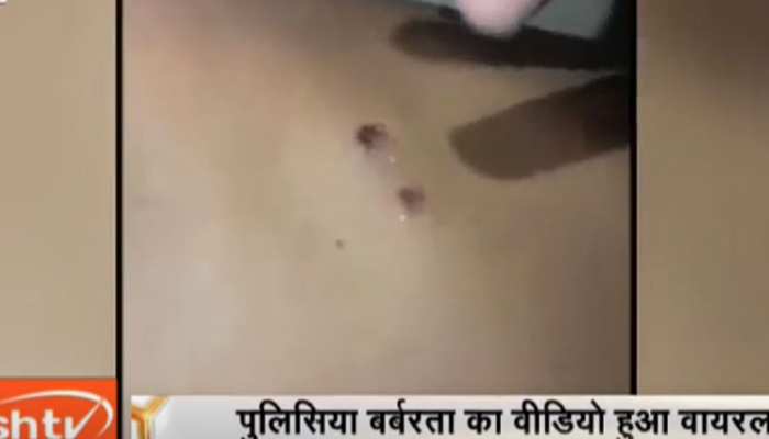थाने में हैवानियत! पुलिस हिरासत में युवक की मौत, चौकी इंचार्ज समेत 3 सस्पेंड थाने में हैवानियत! पुलिस हिरासत में युवक की मौत, चौकी इंचार्ज समेत 3 सस्पेंड