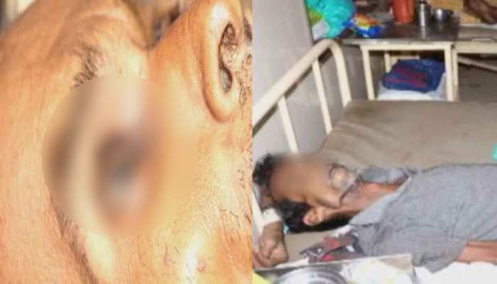 शिवपुरी: सरकारी अस्पताल में बड़ी लापरवाही, शव में लगी चींटियां, 5 डॉक्टर सस्पेंड शिवपुरी: सरकारी अस्पताल में बड़ी लापरवाही, शव में लगी चींटियां, 5 डॉक्टर सस्पेंड