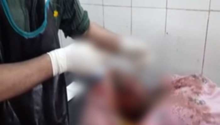 मुजफ्फरपुर: 2 सौतन की लड़ाई में पति ने एक पत्नी की काट दी जुबान मुजफ्फरपुर: 2 सौतन की लड़ाई में पति ने एक पत्नी की काट दी जुबान