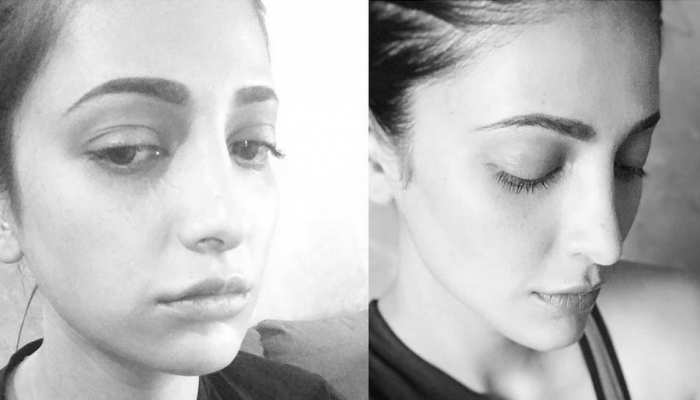 श्रुति हासन ने सोशल मीडिया पर कबूला- हां, मैंने प्लास्टिक सर्जरी करवाई, शर्मिंदा नही