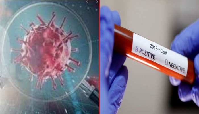 उत्तर प्रदेश में Coronavirus के मरीजों की संख्या हुई 51, नोएडा में पाए गए सबसे अधिक पॉजिटिव मामले उत्तर प्रदेश में Coronavirus के मरीजों की संख्या हुई 51, नोएडा में पाए गए सबसे अधिक पॉजिटिव मामले