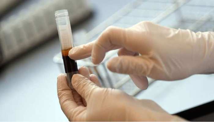 झारखंड: प्लाज्मा थेरेपी से कोरोना संक्रमण को मात देने की तैयारी, रिम्स बना डोनेशन सेंटर झारखंड: प्लाज्मा थेरेपी से कोरोना संक्रमण को मात देने की तैयारी, रिम्स बना डोनेशन सेंटर