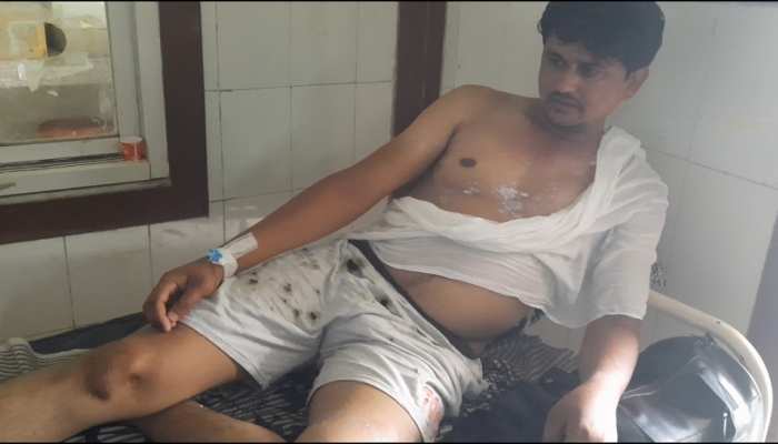 चूरू में दो युवकों पर हुआ एसिड अटैक, आरोपियों की तलाश में पुलिस चूरू में दो युवकों पर हुआ एसिड अटैक, आरोपियों की तलाश में पुलिस