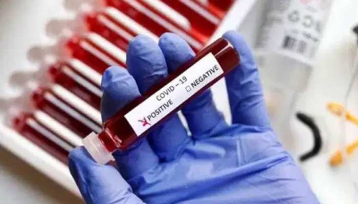 महाराष्ट्र की जेलों में बंद 1043 कैदी कोरोना संक्रमित, 302 जेल कर्मियों की रिपोर्ट भी पॉजिटिव महाराष्ट्र की जेलों में बंद 1043 कैदी कोरोना संक्रमित, 302 जेल कर्मियों की रिपोर्ट भी पॉजिटिव
