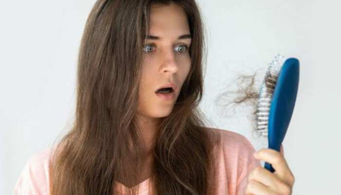 know the reason of hair fall and tips to control it | बाल झड़ने के पीछे हो सकते हैं सेहत से जुड़े ये बड़े कारण, इन उपाय से करें कंट्रोल, Health know the reason of hair fall and tips to control it | बाल झड़ने के पीछे हो सकते हैं सेहत से जुड़े ये बड़े कारण, इन उपाय से करें कंट्रोल, Health