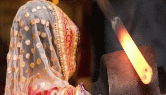 भीलवाड़ा में अंधविश्वास का अंधा खेल, महिला को डायन बताकर गर्म चिमटे से दागा, फिर...