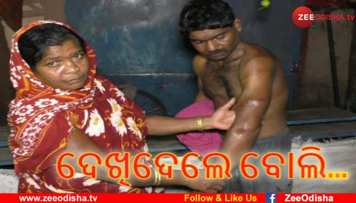 ହୋମଗାର୍ଡଙ୍କ ଆକ୍ରମଣରେ ଯୁବକ ଲହୁଲୁହାଣ ହୋମଗାର୍ଡଙ୍କ ଆକ୍ରମଣରେ ଯୁବକ ଲହୁଲୁହାଣ