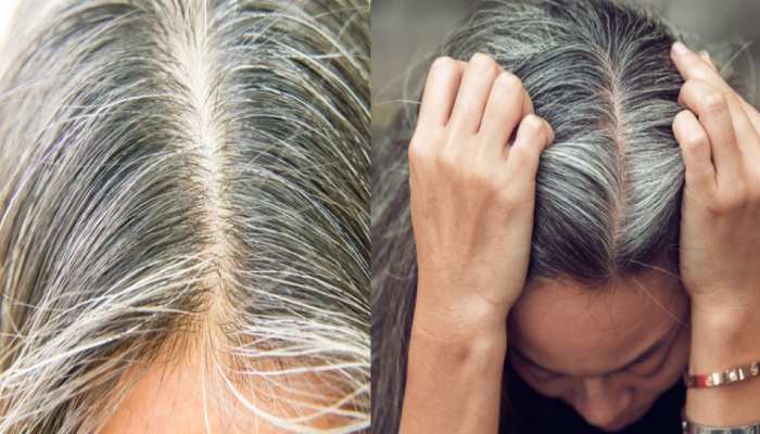 White Hairs problams oil for black hair safed balon ko kala kese kare balo ko kala karne ka upay brmp | इन तेल से हमेशा के लिए दूर होगी सफेद बालों की White Hairs problams oil for black hair safed balon ko kala kese kare balo ko kala karne ka upay brmp | इन तेल से हमेशा के लिए दूर होगी सफेद बालों की