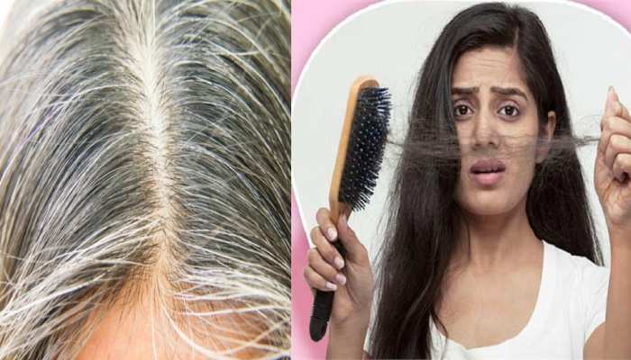 Hair Care Tips These are surefire remedies for white and falling hair balo  ke liye gharelu upay brmp | Hair Care Tips: सफेद और झड़ते बालों के लिए ये  हैं अचूक उपाय,