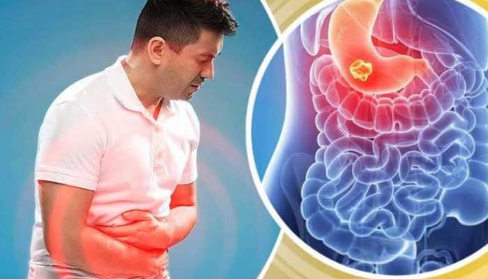 Stomach Cramps Home Remedies These things are beneficial in gas indigestion  constipation abdominal pain and cramps brmp | गैस, ऐंठन, अपच, कब्ज और पेट  दर्द से तुरंत देंगी राहत यह 5 चीजें,