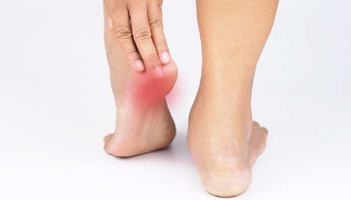 Heel pain clearance medicine in hindi