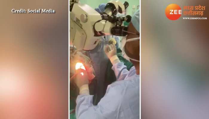doctors doing brain tumour surgery and patient chanting hanuman chalisa video viral on social media ngmp