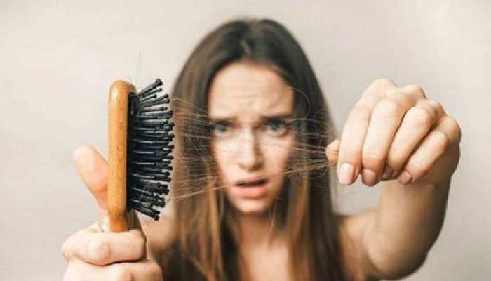 what is hair loss problem solution know here home remedies to stop hair fall brmp | hair loss problem solution: बाल झड़ने से परेशान हैं आप तो आजमाएं ये घरेलू उपाय, hair what is hair loss problem solution know here home remedies to stop hair fall brmp | hair loss problem solution: बाल झड़ने से परेशान हैं आप तो आजमाएं ये घरेलू उपाय, hair