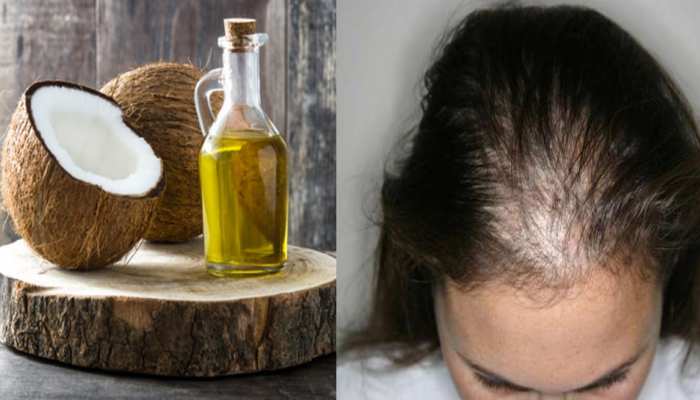 Shampoo prepared with coconut oil is beneficial for hair know here Benefits  of coconut oil for hair brmp | नारियल तेल से घर बैठे तैयार करें यह कमाल की  शैंपू, बालों के