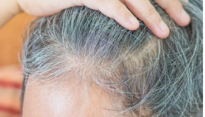 white hair problem solution know here home remedies for dark hair brmp | white hair problem solution: आपके भी होते हैं सफेद बाल तो अपना लीजिए ये घरेलू उपाय, हेयर रहेंगे काले-घने | white hair problem solution know here home remedies for dark hair brmp | white hair problem solution: आपके भी होते हैं सफेद बाल तो अपना लीजिए ये घरेलू उपाय, हेयर रहेंगे काले-घने |