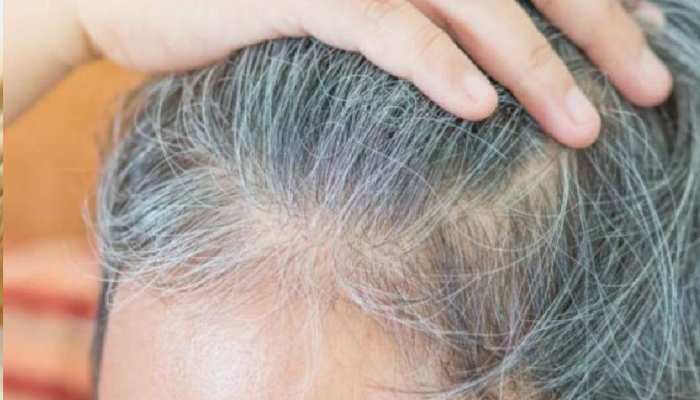 white Hair Problem solution Natural ways to darken hair brmp | सफेद होते बालों की समस्‍या को जड़ से खत्‍म कर सकते हैं यह घरेलू उपाय, Hair दिखने लगेंगे काले और बेहद