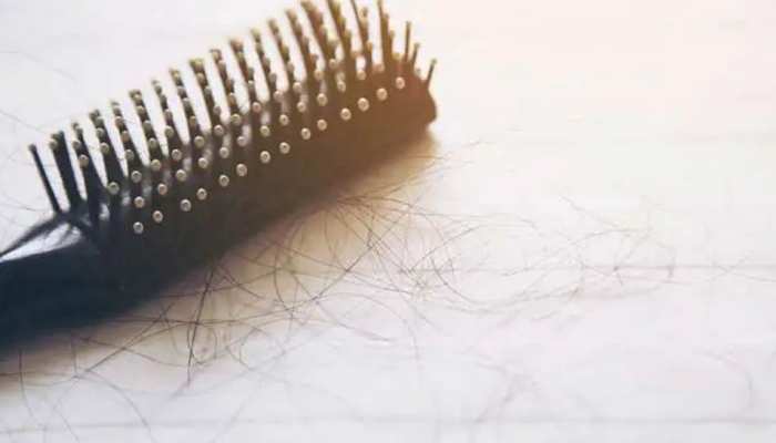 hair loss warning signs your hair fall is something more serious | इन गंभीर बीमारियों का संकेत भी हो सकता है बालों का झड़ना, पहचानें ये लक्षण | Hindi News, लाइफस्टाइल hair loss warning signs your hair fall is something more serious | इन गंभीर बीमारियों का संकेत भी हो सकता है बालों का झड़ना, पहचानें ये लक्षण | Hindi News, लाइफस्टाइल