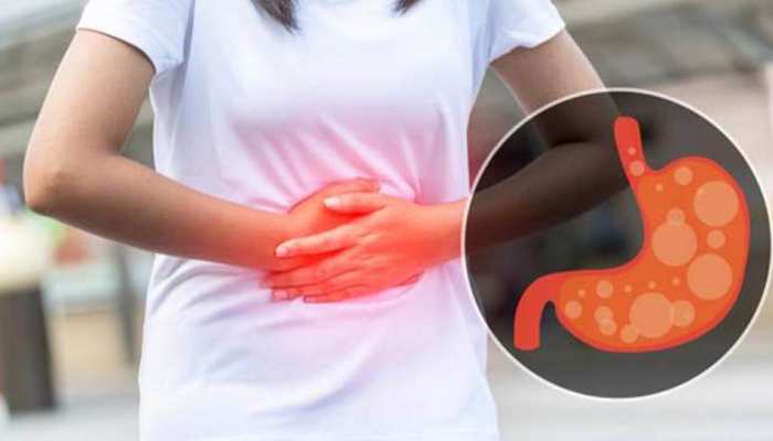Intestinal Gas: इन 6 वजहों से पेट में हमेशा बनी रहती है गैस, तुरंत बदल दें ये आदतें Intestinal Gas: इन 6 वजहों से पेट में हमेशा बनी रहती है गैस, तुरंत बदल दें ये आदतें