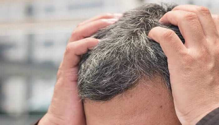 white hair causes and solution know how to control white hair and white  hair treatment samp | White Hair causes: इन कारणों से हो जाते हैं कम उम्र  में सफेद बाल, जानें