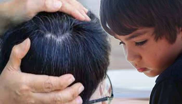 causes of white hair in kids know home remedies of white hair problem or  premature greying samp | White hair in kids: इन कारणों से बच्चों के बाल भी  हो जाते हैं