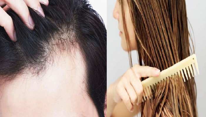 hair care tips Winter Hair Fall Tips home remedies for hair fall | सर्दियों में बालों का झड़ना तुरंत कम करेंगे ये आसान घरेलू उपाय | Hindi News, लाइफस्टाइल hair care tips Winter Hair Fall Tips home remedies for hair fall | सर्दियों में बालों का झड़ना तुरंत कम करेंगे ये आसान घरेलू उपाय | Hindi News, लाइफस्टाइल