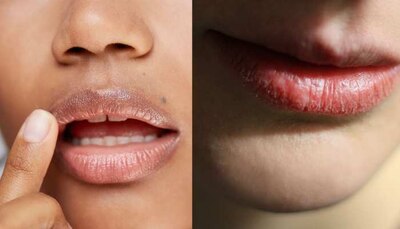 lips care tips how to remove lips dead skin how to make lips beautiful brmp  | lips care TIPS: होंठों की डेड स्किन हटा देंगी ये चीजें, खूबसूरत और गुलाबी  दिखने लगेंगे