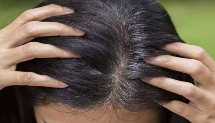 White Hair 5 Effective Remedies Amla Powder Curry Leaves Indigo Henna Coconut Oil Lemon Black Tea | 20 से 25 साल की उम्र में बाल हो रहे हैं सफेद, इन 6 घरेलू White Hair 5 Effective Remedies Amla Powder Curry Leaves Indigo Henna Coconut Oil Lemon Black Tea | 20 से 25 साल की उम्र में बाल हो रहे हैं सफेद, इन 6 घरेलू