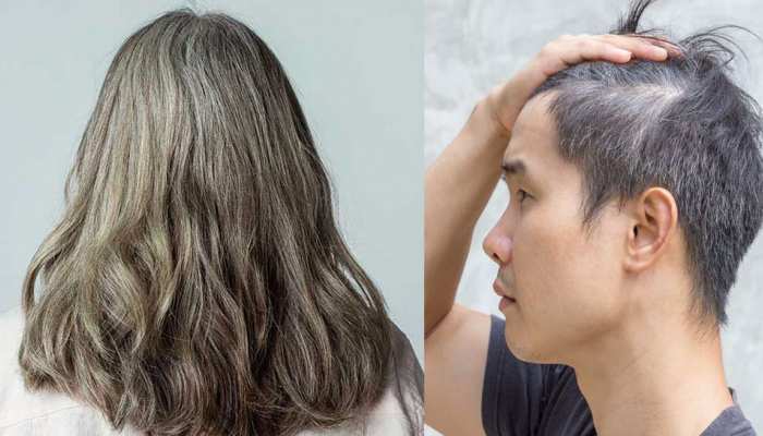 Potato Peel for Premature White Hair Problems Solution Home remedies Vegetable Black| इस सब्जी के छिलके से सफेद बाल हो जाएंगे काले, जानिए इस्तेमाल का आसान तरीका | Hindi News Potato Peel for Premature White Hair Problems Solution Home remedies Vegetable Black| इस सब्जी के छिलके से सफेद बाल हो जाएंगे काले, जानिए इस्तेमाल का आसान तरीका | Hindi News