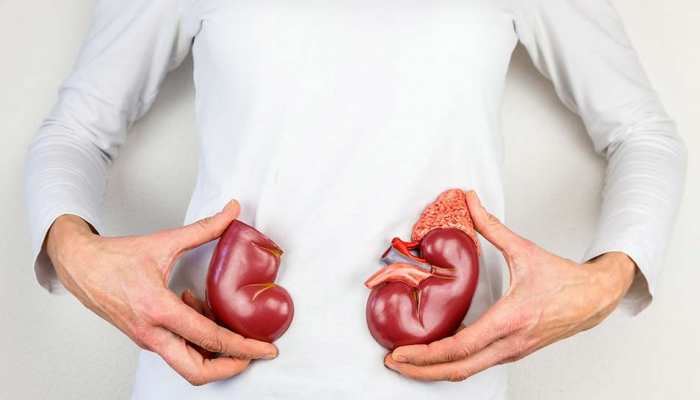 Kidney को खराब होने से बचाना है तो इन फूड्स को छोड़ें, वरना होगी परेशानी