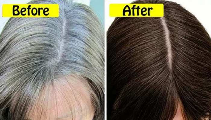 Blacken Hair TIPS Use these 3 things to make hair black natural hair products White hair treatment brmp | Blacken Hair TIPS: सफेद बालों से परेशान हैं तो लगाएं ये 3 चीजें, Blacken Hair TIPS Use these 3 things to make hair black natural hair products White hair treatment brmp | Blacken Hair TIPS: सफेद बालों से परेशान हैं तो लगाएं ये 3 चीजें,