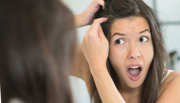 White Hair Treatment by naturally know premature white hair problem home remedies | White Hair Treatment: सफेद बाल किसकी कमी से होते हैं? यहां जानें हेयर को काला करने का आसान तरीका | White Hair Treatment by naturally know premature white hair problem home remedies | White Hair Treatment: सफेद बाल किसकी कमी से होते हैं? यहां जानें हेयर को काला करने का आसान तरीका |