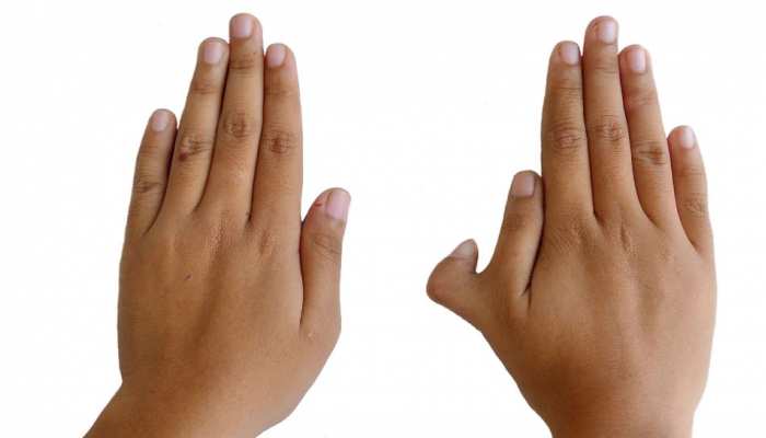क्या आप जानते हैं हाथ में 6 उंगलियां होने का मतलब? सामुद्रिक शास्त्र में है वर्णन