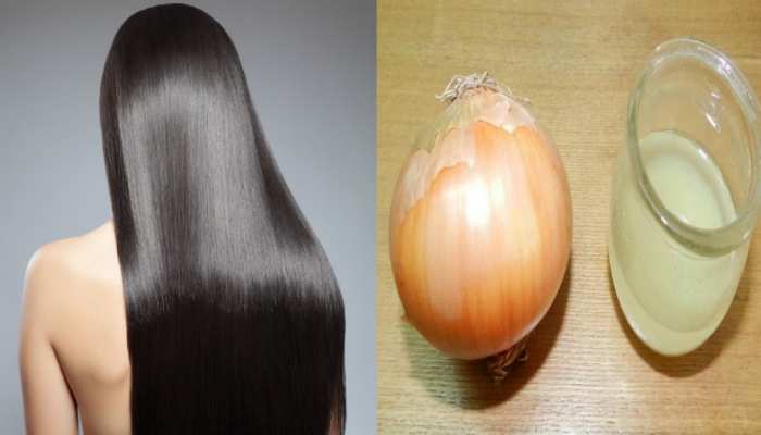 Hair Care TIPS Hair Growth Tips Benefits of applying onion juice on hair  BRMP | बेहतर ग्रोथ के लिए बालों में इस तरह लगाएं प्याज का रस, हेयर हो  जाएंगे मजबूत, काले