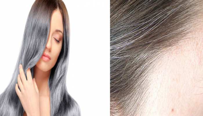White Hair Treatment best treatment for get black hairs Vitamin B12  Deficiency | White Hair Treatment: कम उम्र में बाल सफेद क्यों होते हैं?  कहीं आपकी बॉडी में तो नहीं हो रही