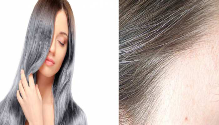 White Hair Treatment best treatment for get black hairs Vitamin B12 Deficiency | White Hair Treatment: कम उम्र में बाल सफेद क्यों होते हैं? कहीं आपकी बॉडी में तो नहीं हो रही White Hair Treatment best treatment for get black hairs Vitamin B12 Deficiency | White Hair Treatment: कम उम्र में बाल सफेद क्यों होते हैं? कहीं आपकी बॉडी में तो नहीं हो रही