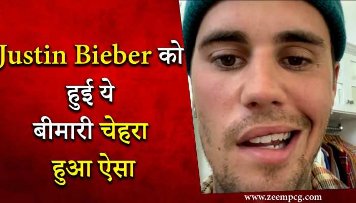 justin Beiber का इस खतरनाक बीमारी से चेहरा हो गया ऐसा, पोस्ट शेयर कर खुद दी जानकारी