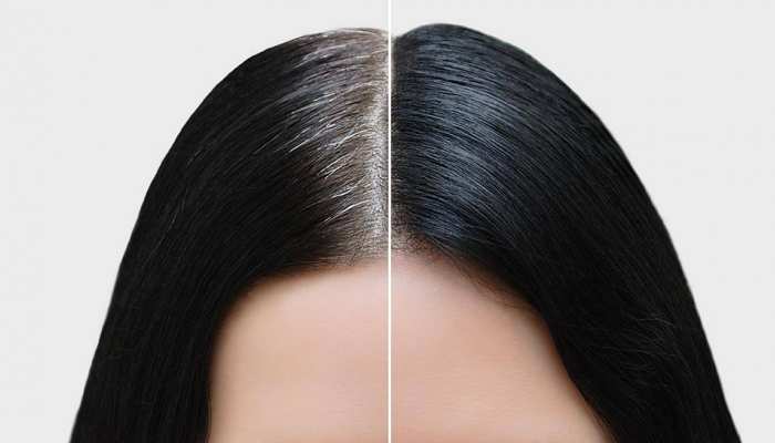 natural solution to get black hair from white hair problem know how to make hair black samp | Natural Black Hair: कम उम्र में बूढ़ा बना देते हैं सफेद बाल, इन नैचुरल natural solution to get black hair from white hair problem know how to make hair black samp | Natural Black Hair: कम उम्र में बूढ़ा बना देते हैं सफेद बाल, इन नैचुरल