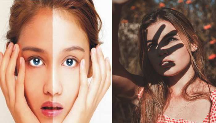 Skin Tanning: चिलचिलाती धूप से चेहरा हो गया टैन? इस तरह पाएं Sunburn से छुटकारा