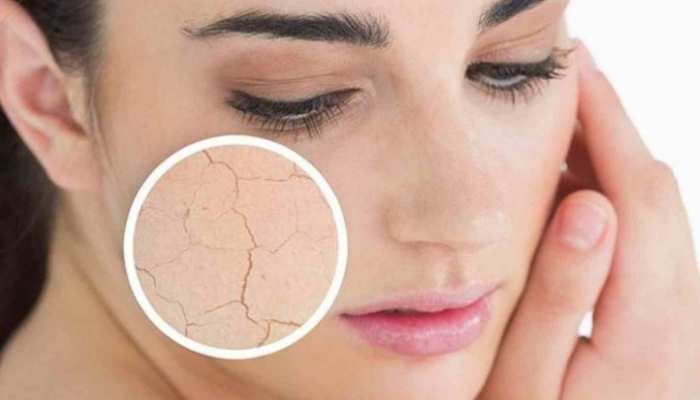 Home remedies for dry skin: Follow these 4 tips to get moisturized skin |  Home Remedy for Dry Skin Skin Care Tips